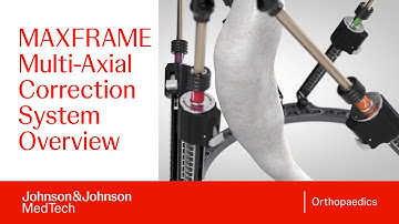 How Does the MAXFRAME Multi-Axial Correction System Work for Deformity Correction? | J&J MedTech
