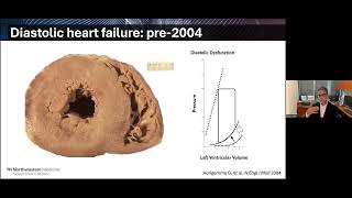 Freeing Ourselves from Cardio-Myopia: A New Vision for the Future of Heart Failure
