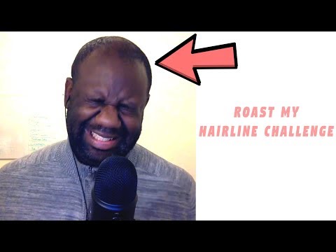My Mean  Subscribers Roasted My Hairline SMH