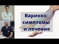 Варикоз: симптомы и лечение - как сохранить здоровье ног?