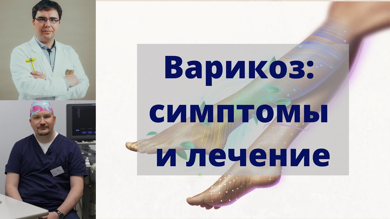 Варикоз: симптомы и лечение - как сохранить здоровье ног? - YouTube