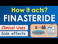 Finasteride || How it acts? || Mechanism, side effects & uses