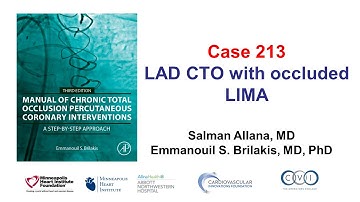 Case 213: Manual of CTO PCI - LAD in-stent CTO with occluded LIMA