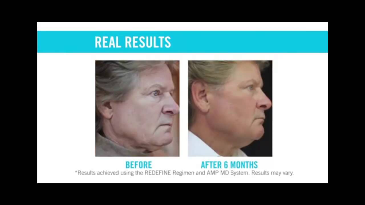 Rodan + Fields REDEFINE Regimen - YouTube