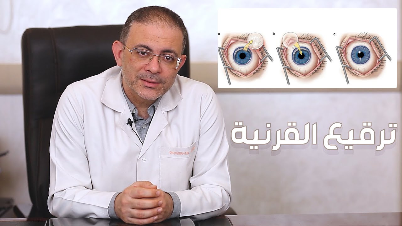 ما هي عملية ترقيع القرنية دكتور محمد قابيل
