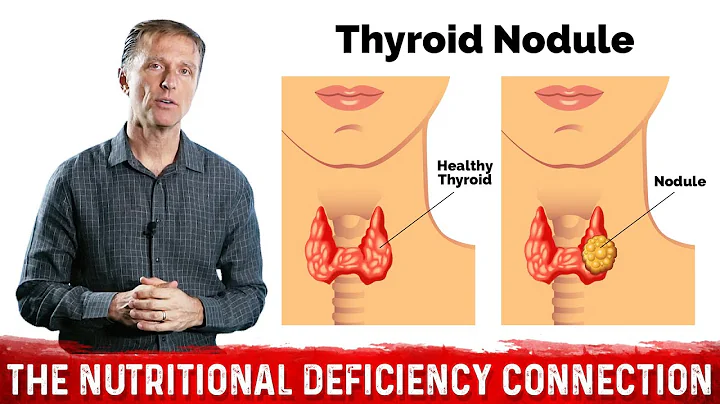 What's Behind Thyroid Nodules? Thyroid Disorders & Selenium Deficiency – Dr.Berg - DayDayNews
