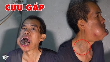 CỨU 1 MẠNG NGƯỜI HƠN XÂY 7 TÒA THÁP. BỆNH UNG THƯ ÁC TÍNH LÀ NHẤT CHƯA GẶP BAO GIWOF CỦA ÔNG TẠO