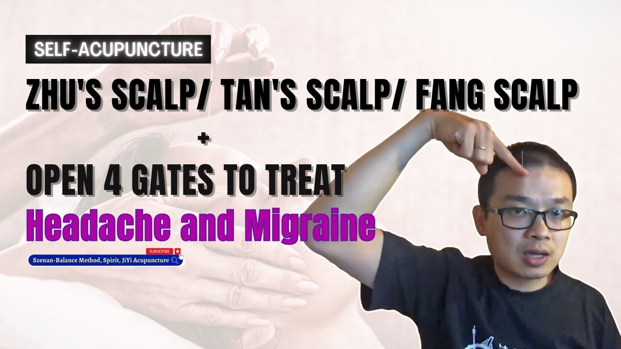 Self-Acupuncture- Zhu's Scalp/Tan's Scalp/Fang Scalp + Open 4 gates to