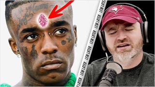 Fans Ripped The $24 Million Diamond Off Lil Uzi Vert's Face...
