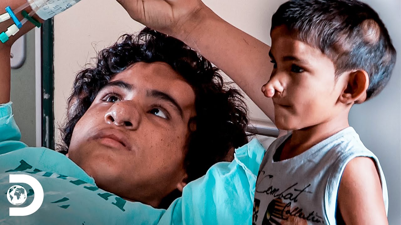 Remoção de caroços no nariz de dois irmãos | Meu Corpo, Meu Desafio | Discovery Brasil