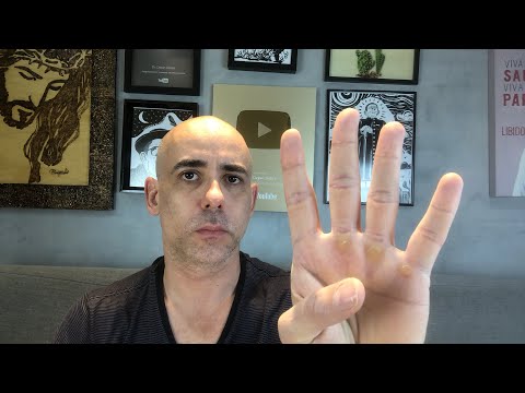 4 sinais de que você pode estar com câncer | Dr Dayan Siebra dr dayan siebra ao vivo