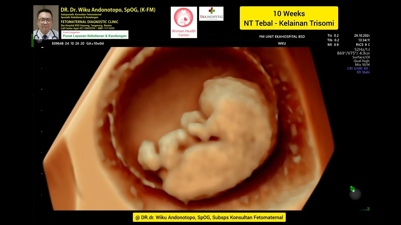 10 Weeks kelainan Genetika Kromosom