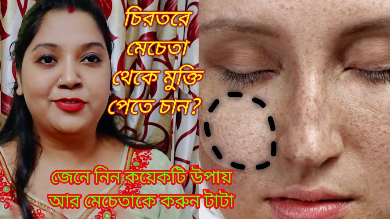 mecheta remove cream