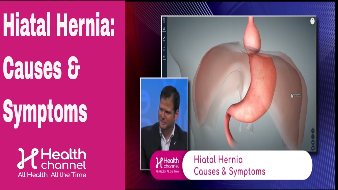 Hiatal Hernia Causes And Symptoms Youtube 