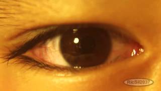 Just a 9 year old's eye iris in slow motion