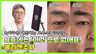 눈가주름 개선엔 보톡스? 리쥬란? 요즘은 &#39;이것&#39;으로 없애요! 콜라겐주사