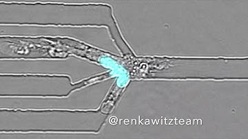 Dendritic Cell Migrating in a Pore Size Decision Channel