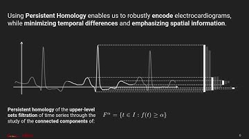 2020 - Topological Data Analysis for Arrhythmia Detection through Modular Neural Networks