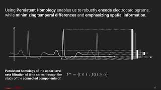 2020 - Topological Data Analysis for Arrhythmia Detection through Modular Neural Networks