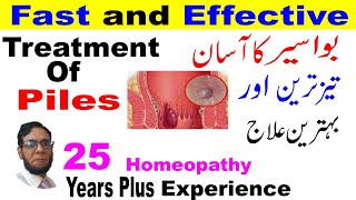 Bawaseer Piles ka ilaj-Homeopathic Piles Treatment in Urdu!