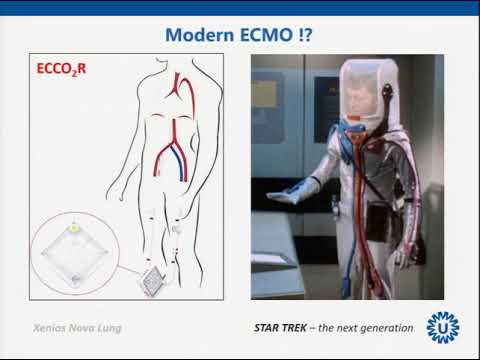 Video: Penilaian Aliran Rendah Pompa Darah Putar ECMO / ECCO 2 R Saat Ini Dan Efek Potensial Pada Kompatibilitas Hemokompatibel