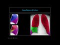 How To Read Chest X Ray Dr Ismail Sayed Ismail 