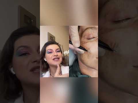 Vídeo: Como preparar a pele para um peeling químico: 13 etapas (com fotos)