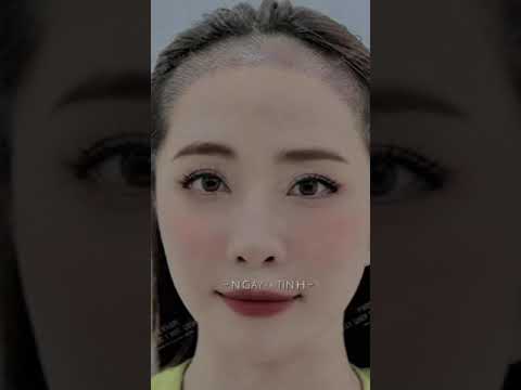 Video Diễn viên Quỳnh Nga cấy tóc sau 10 ngày nhận nhiều ý... - youtube