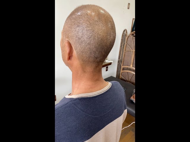頭頂部の薄毛はげがバリカン坊主に 薄毛はげでもカッコイイおしゃれ坊主 Shorts Youtube