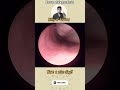 콧물제거영상 #nose #satisfyingvideo #cleaning #asmr