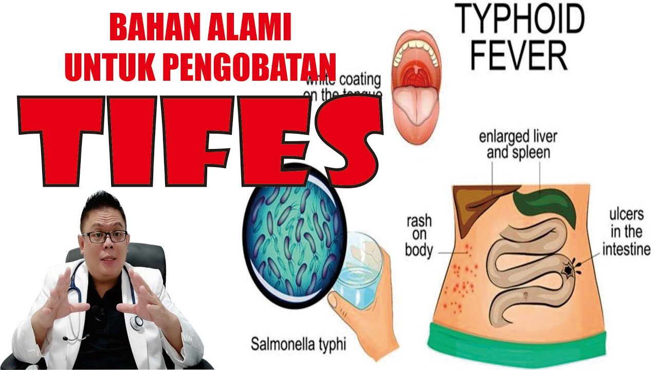 BAHAN-BAHAN ALAMI UNTUK PENGOBATAN TIFES