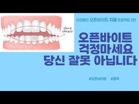 오픈바이트 두번째 이야기