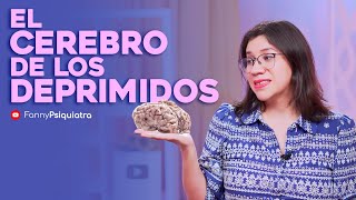 EL CEREBRO DE LOS DEPRIMIDOS by Fanny Psiquiatra 20,703 views 5 months ago 13 minutes, 48 seconds