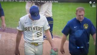 From Made the Cut: we just saw one of the ugliest injuries you'll ever see on an MLB field