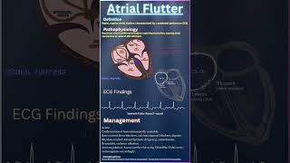 🫀⚡Atrial Flutter: Quick Guide What is it?🫀