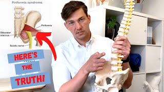 Piriformis Syndrome & the TRUTH About Sciatica!