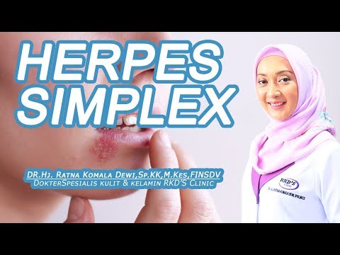 Herpes Simplex? Ini Cara Menyembuhkannya!