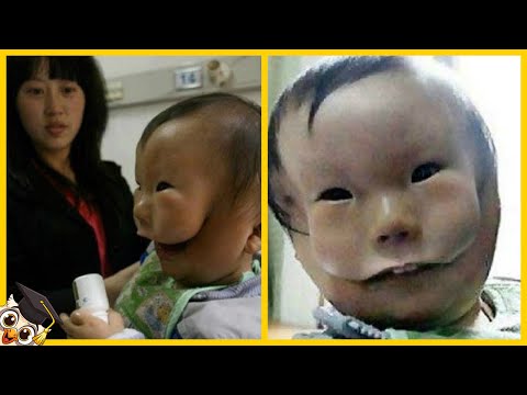 Video: Blind van geboorte, dit jong heeft het onaangename vermogen om het goede in mensen te zien
