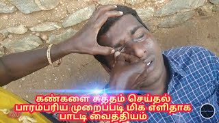 கண்களை சுத்தம் செய்தல் மிகவும் எளிதானது இதோ உதாரணம்