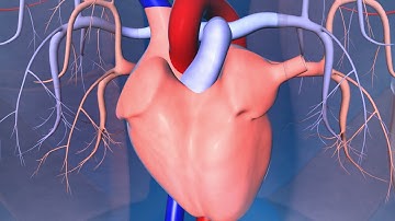 Catheter Ablation: What is it and how does it help an irregular heart beat?