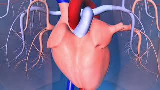 Catheter Ablation: What is it and how does it help an irregular heart beat? screenshot 4
