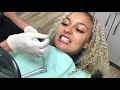 Houston Cosmetic Dentist..How do I decide how many Lumineers I need? Color?