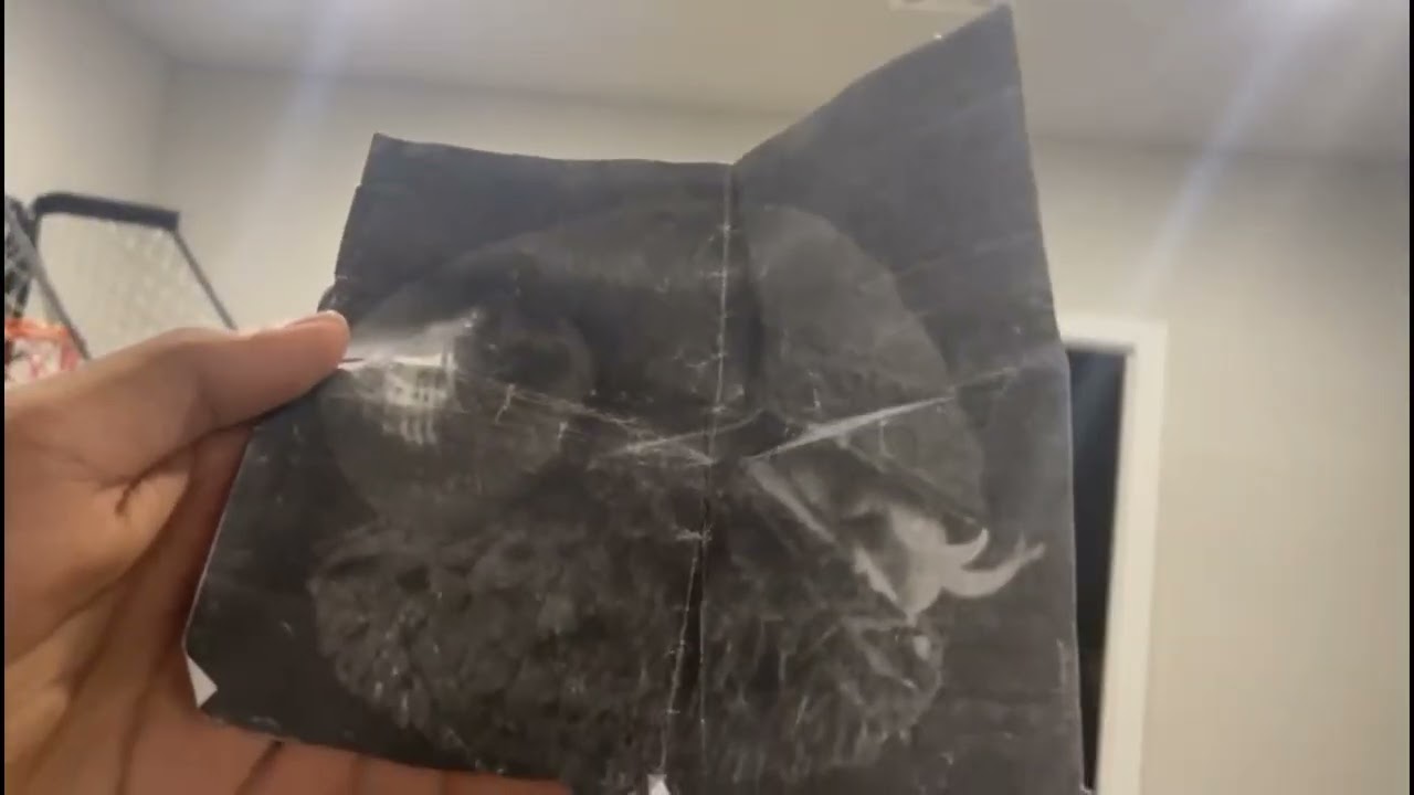 Bio Project:Around the Visceral Mass