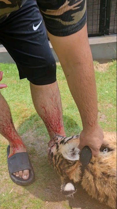 Tiger Bites and Injured my Leg | Nouman Hassan |