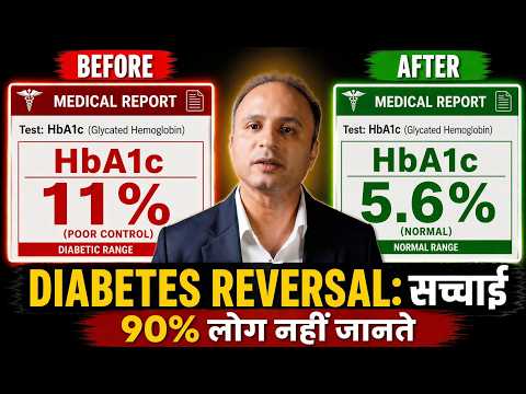 Is Diabetes Reversal a Fact or a Myth? | Who Can Reverse It? Diabetes Remission Explained |