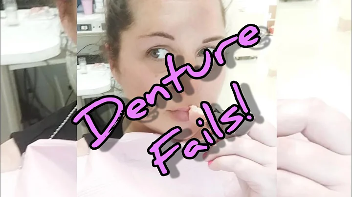 EPIC FAILS WITH DENTURES #denturefails #dentures #denturesupport #denturewearer #denturehelp