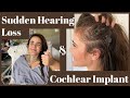 Sudden Hearing Loss, Deafness, Cochlear Implant Journey