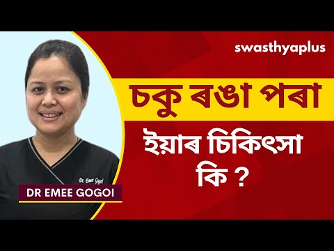 চকু ৰঙা পৰা: কাৰণ আৰু প্ৰতিৰোধ | Redness in Eye: How to Treat? in Assamese | Dr Emee Gogoi