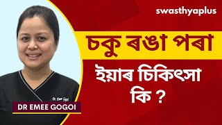 চকু ৰঙা পৰা: কাৰণ আৰু প্ৰতিৰোধ | Redness in Eye: How to Treat? in Assamese | Dr Emee Gogoi