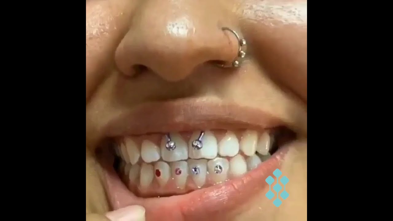 Piercing Dental YouTube